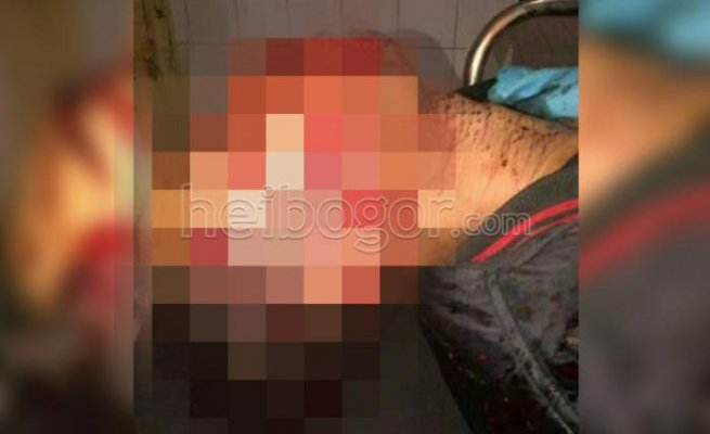 Hendak Tolong Korban, Ahmad Malah Ditembak Pelaku Begal